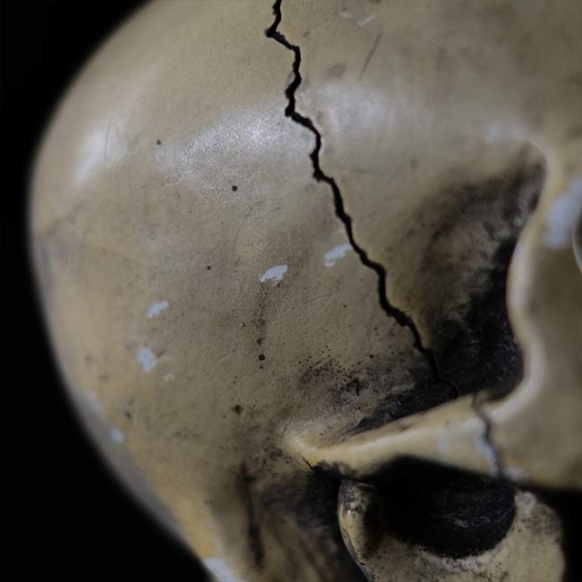 RANDOTTI skull object