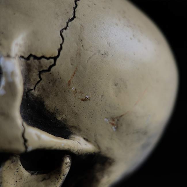 RANDOTTI skull object