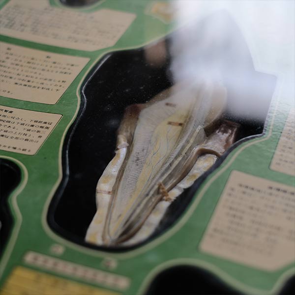 歯科標本